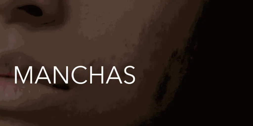 Guía completa del melasma