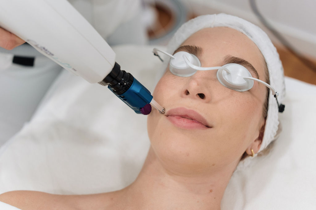 Tratamiento de manchas y melasma en Sevilla